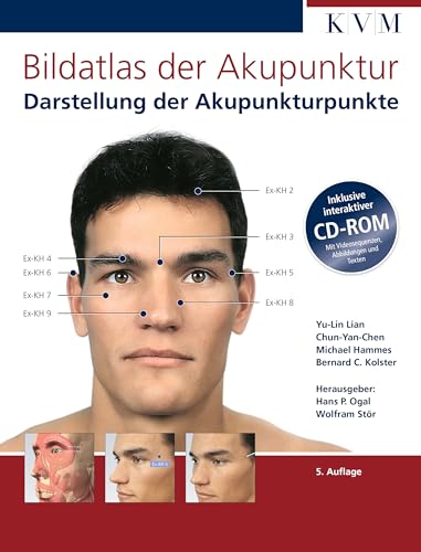 Bildatlas der Akupunktur: Darstellung der Akupunkturpunkte (inkl. CD-ROM) von KVM-Der Medizinverlag